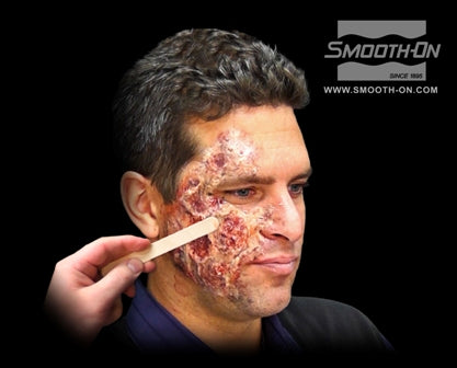 Skin Tite Ultimate Wound Kit