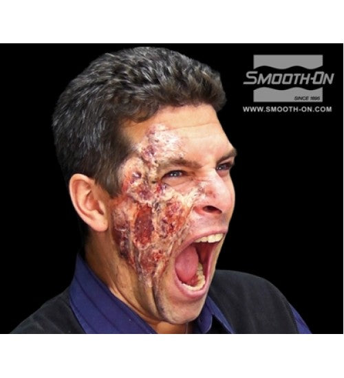 Skin Tite Ultimate Wound Kit